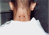 39p.gif (5916 octets)